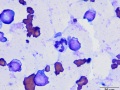Dysplastic neutrophil (cat, AML)