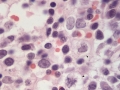 MDS (cat, H&E)