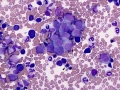 Focus of myeloid precursors (dog)