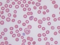 Multiple  micronuclei (vincristine)
