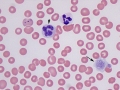 Multiple micronuclei (vincristine)