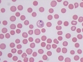 Multiple micronuclei (vincristine)