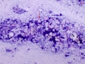 Otitis (dog)