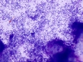 Otitis (dog)