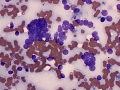 Chemodectoma