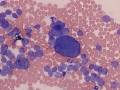 Chemodectoma