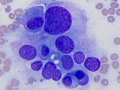 Chemodectoma