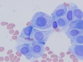 Chemodectoma