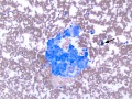 Chemodectoma