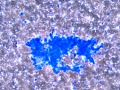 Chemodectoma