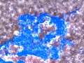 Chemodectoma