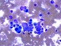 Chemodectoma