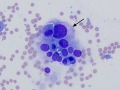 Chemodectoma
