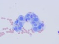 Chemodectoma