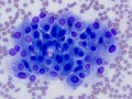Chemodectoma