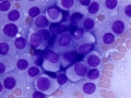 Thyroid C cell tumor (dog)