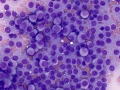 Thyroid C cell tumor (dog)