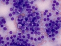 Thyroid C cell tumor (dog)