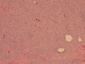 Thyroid C cell tumor (dog)