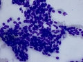 Suspect trichoblastoma (cat, DQ)