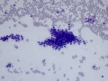 Suspect trichoblastoma (cat, DQ)
