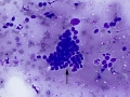 Suspect trichoblastoma (cat, DQ)