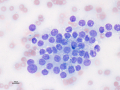 Anal sac adenocarcinoma