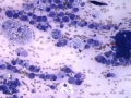 Trichoblastoma (dog, granular variant)
