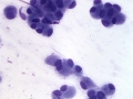 Trichoblastoma (dog, granular variant)