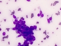 Trichoblastoma (spindled variant, cat)