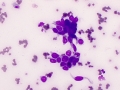 Trichoblastoma (spindled variant, cat)