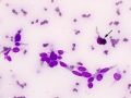 Trichoblastoma (spindled variant, cat)