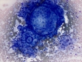 Thyroid adenoma (horse)