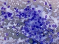 Thyroid adenoma (horse)