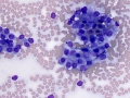 Thyroid adenoma (horse)