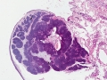 Trichoblastoma (dog, granular variant, H&E)