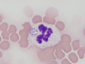 Anaplasma phagocytophilum