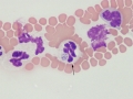 Anaplasma phagocytophilum