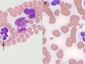 Anaplasma compilation