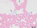 Fibrin
