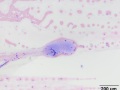 Fibrin