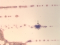 Platelet clump