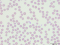 Red blood cells (DQ)