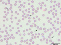 Red blood cells (DQ)