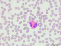Eosinophil (DQ)
