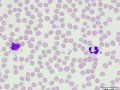 Neutrophil & lymphocyte (DQ)