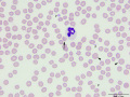 Neutrophil (DQ)