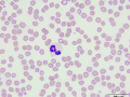 Neutrophil (DQ)