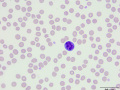 Reactive lymphocyte (DQ)