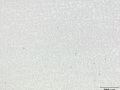 Monolayer (DQ)